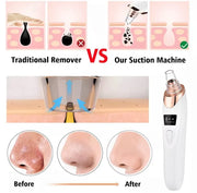 5in1 Blackhead Remover Machine Rechargeable | Face Vacuum Derma Suction With 5 Heads | Blackhead Removing Machine